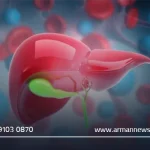 بهترین بیمارستان برای عمل کیسه صفرا