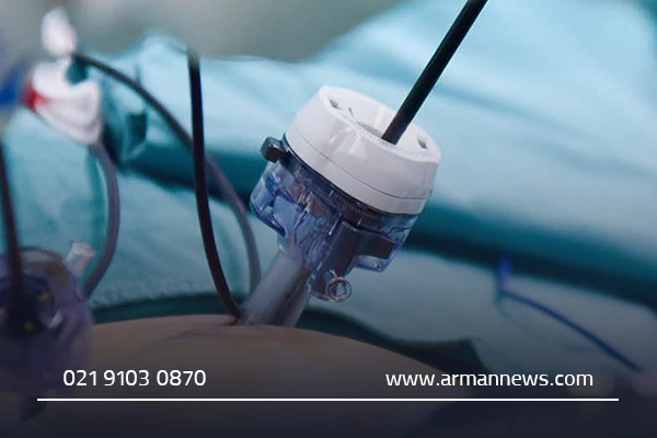 بهترین بیمارستانها برای عمل کیسه صفرا در قم