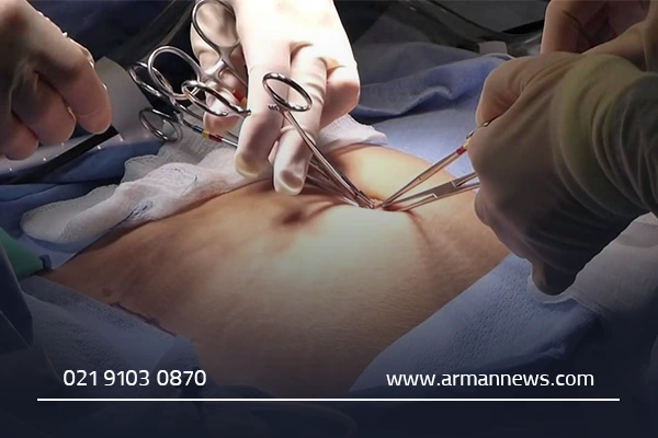 معیارهای انتخاب بهترین بیمارستان برای عمل کیسه صفرا در قم