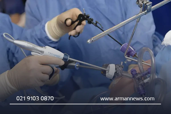 علائم نیاز به عمل کیسه صفرا