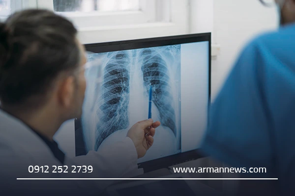 روش‌های تشخیص بیماری‌های ریوی