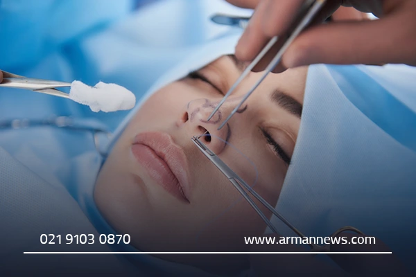 چرا انتخاب بهترین جراح بینی گوشتی اهمیت دارد؟