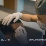 کاشت مو قم: بهترین کلینیک‌ها، روش‌ها و نکات طلایی برای داشتن موهای پرپشت