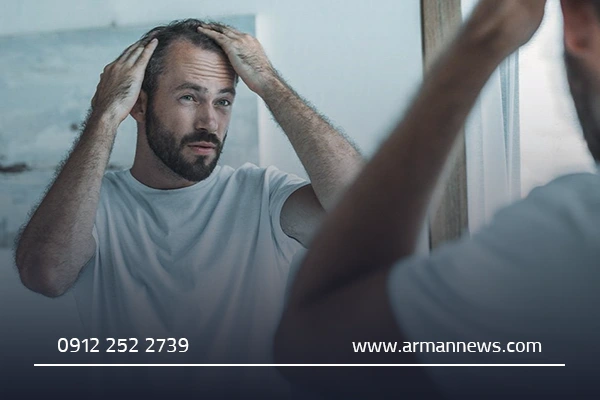 معرفی بهترین کلینیک‌های کاشت مو در قم