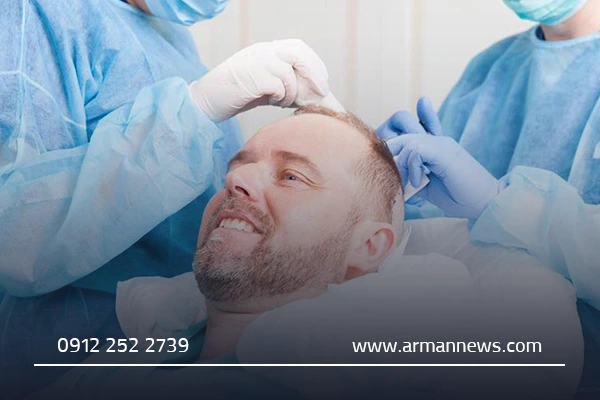 روش‌های کاشت مو در قم